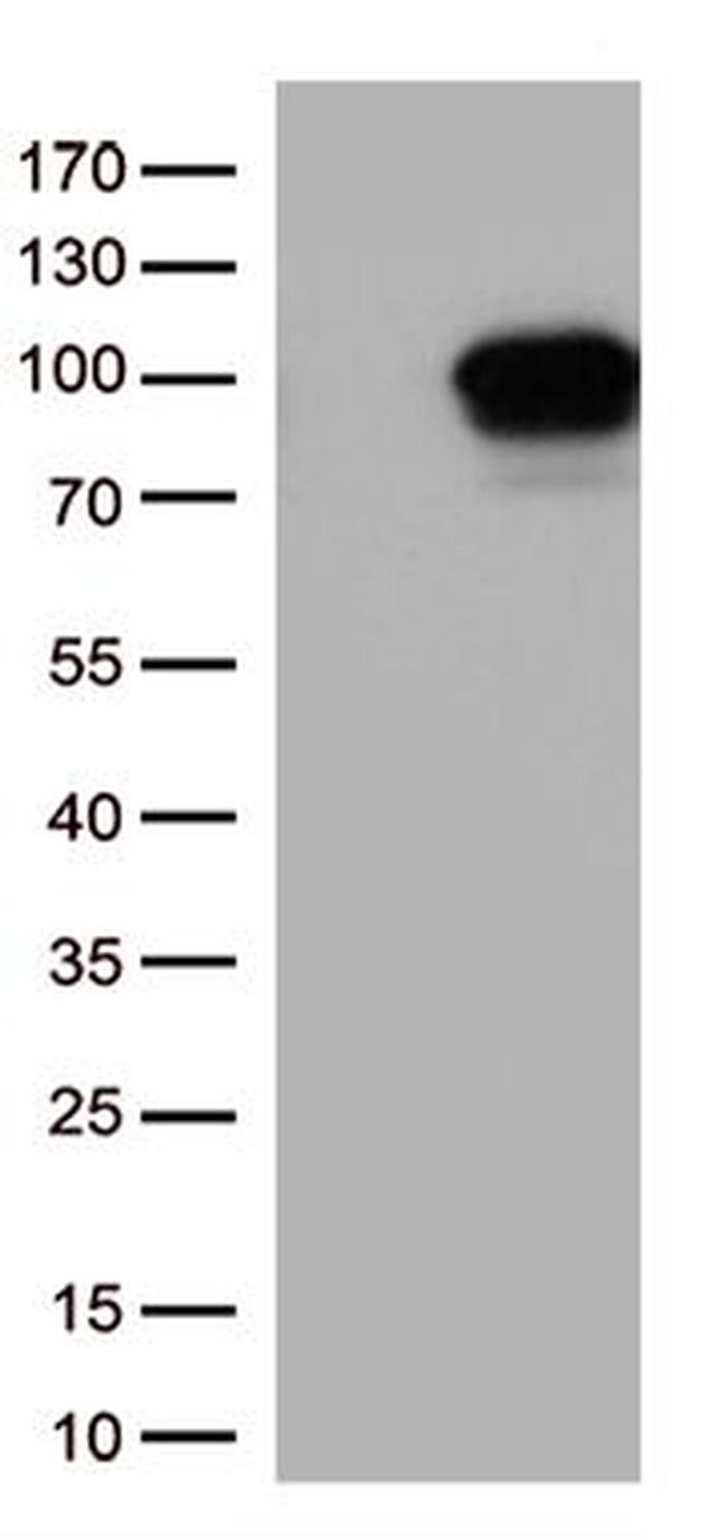 DDX4 Antibody in Western Blot (WB)