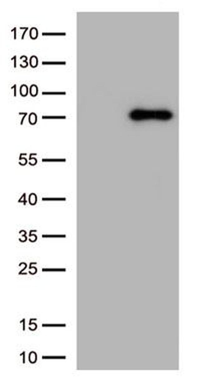 PRKCA Antibody in Western Blot (WB)