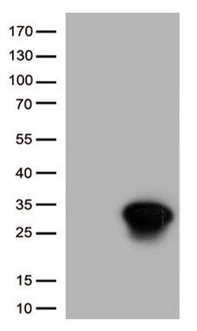 HSPB1 Antibody in Western Blot (WB)