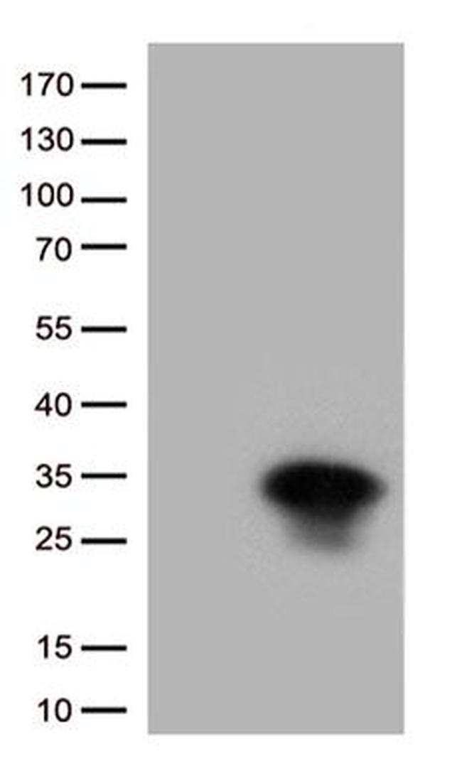 HSPB1 Antibody in Western Blot (WB)