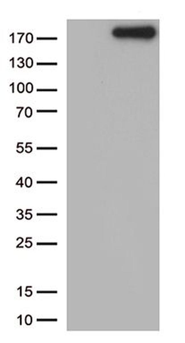 NPHS1 Antibody in Western Blot (WB)