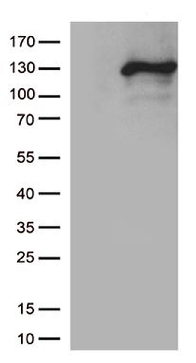 NOS2 Antibody in Western Blot (WB)
