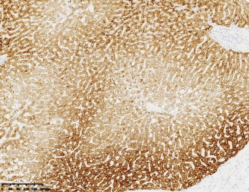 CPS1 Antibody in Immunohistochemistry (Paraffin) (IHC (P))