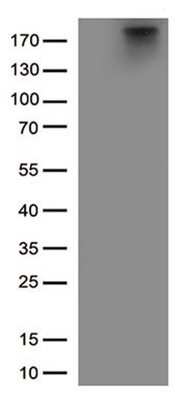 MAP2 Antibody in Western Blot (WB)