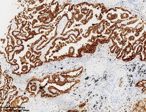NAPSA Antibody in Immunohistochemistry (Paraffin) (IHC (P))