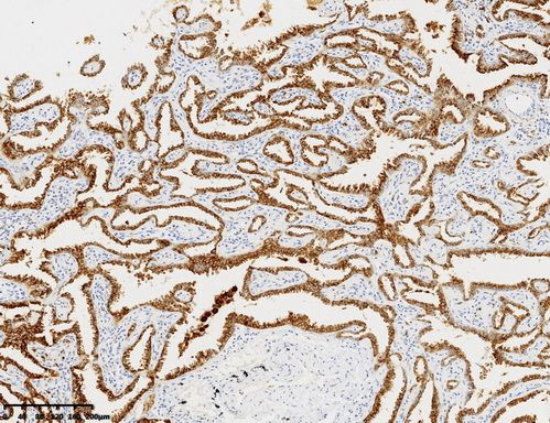 NAPSA Antibody in Immunohistochemistry (Paraffin) (IHC (P))