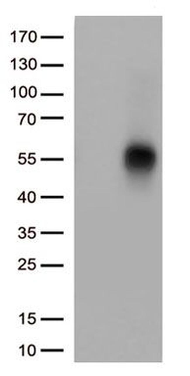 TNFRSF14 Antibody in Western Blot (WB)