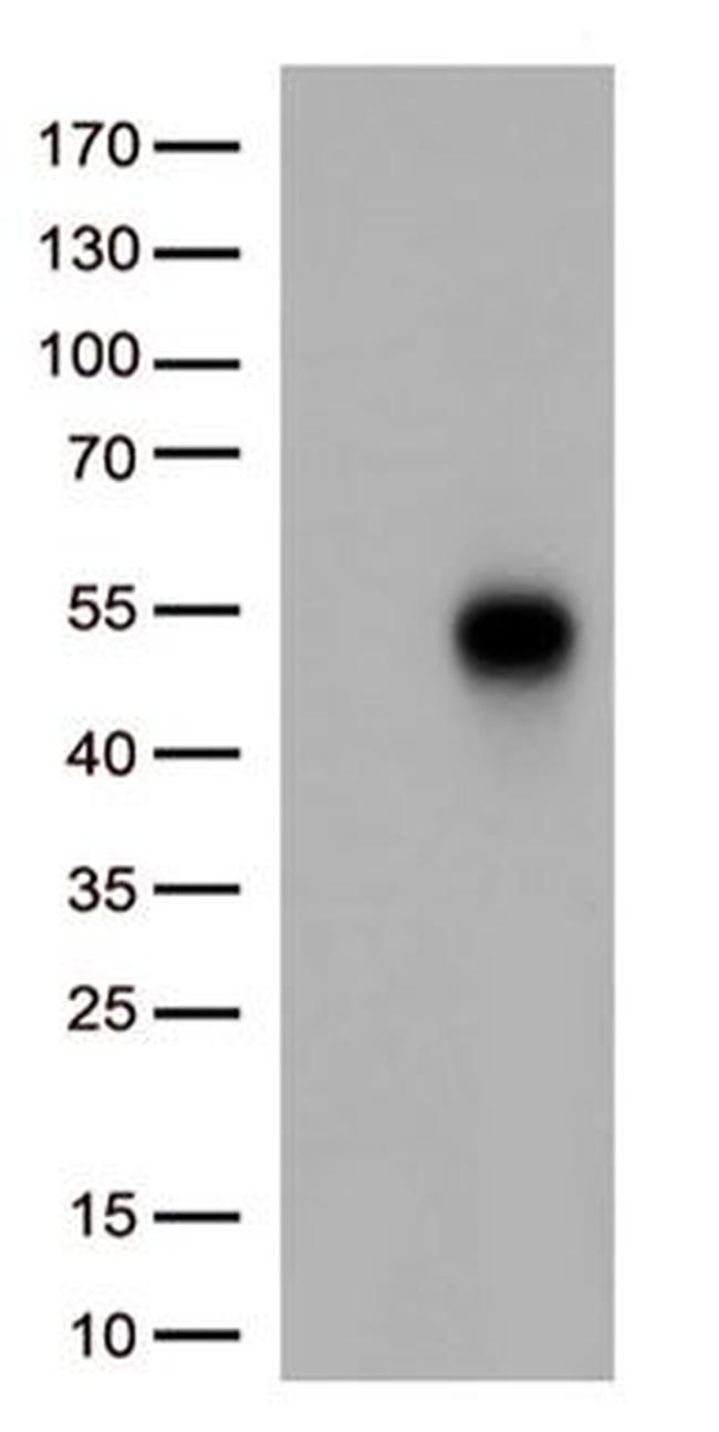 TNFRSF14 Antibody in Western Blot (WB)