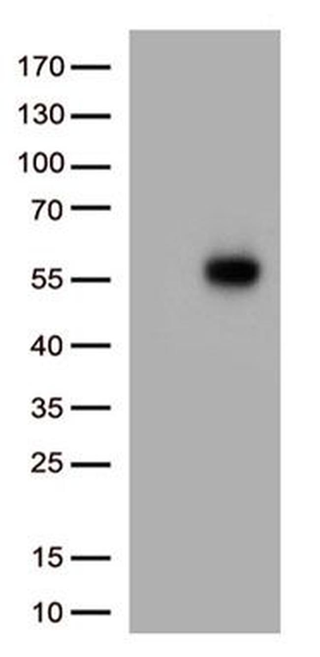 IL3RA Antibody in Western Blot (WB)