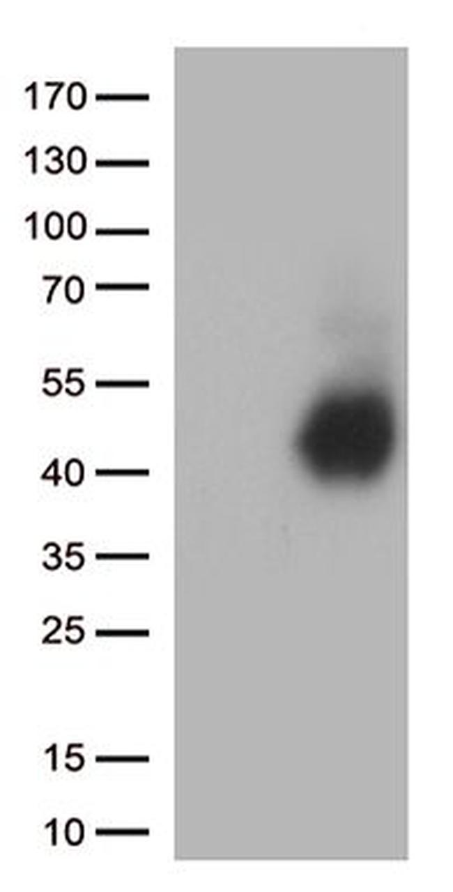 CD28 Antibody in Western Blot (WB)