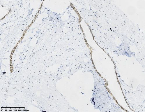FOXP1 Antibody in Immunohistochemistry (Paraffin) (IHC (P))