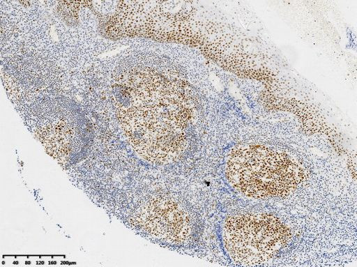 MLH1 Antibody in Immunohistochemistry (Paraffin) (IHC (P))