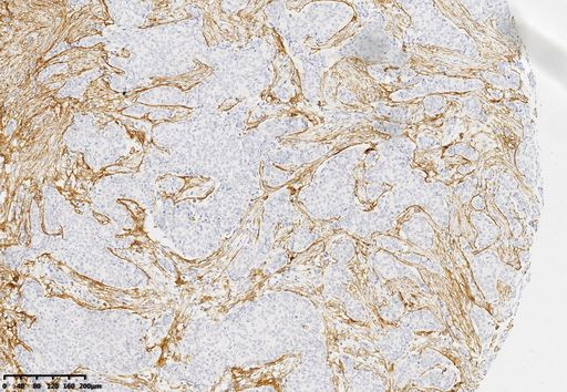 SDC1 Antibody in Immunohistochemistry (Paraffin) (IHC (P))