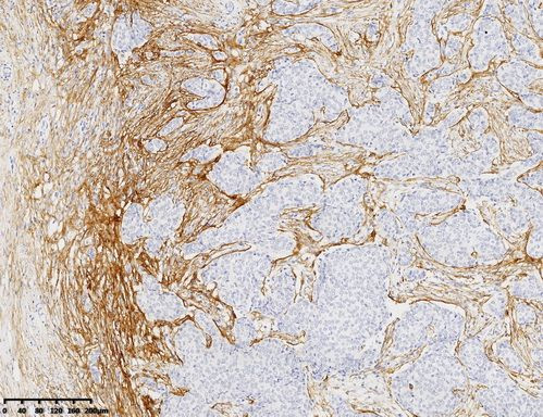 SDC1 Antibody in Immunohistochemistry (Paraffin) (IHC (P))