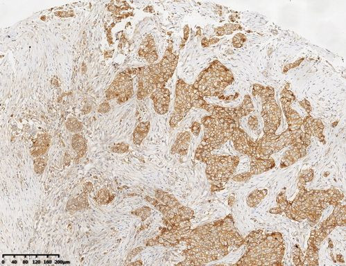 p120-catenin Antibody in Immunohistochemistry (Paraffin) (IHC (P))