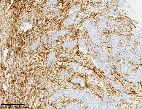 SDC1 Antibody in Immunohistochemistry (Paraffin) (IHC (P))