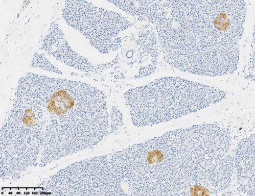 NSE Antibody in Immunohistochemistry (Paraffin) (IHC (P))