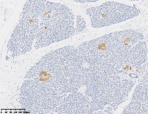 NSE Antibody in Immunohistochemistry (Paraffin) (IHC (P))