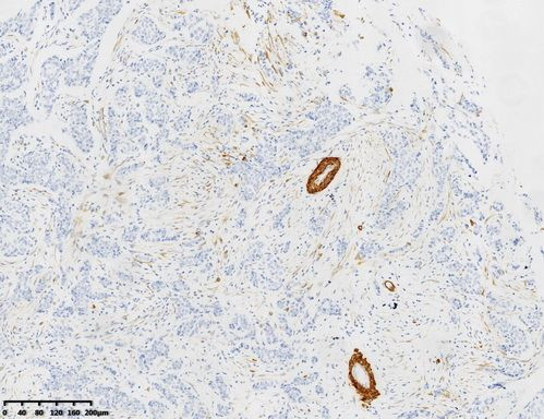 Calponin1 Antibody in Immunohistochemistry (Paraffin) (IHC (P))