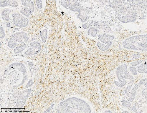 Calponin1 Antibody in Immunohistochemistry (Paraffin) (IHC (P))