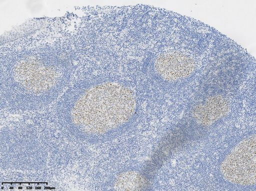 BCL-6 Antibody in Immunohistochemistry (Paraffin) (IHC (P))