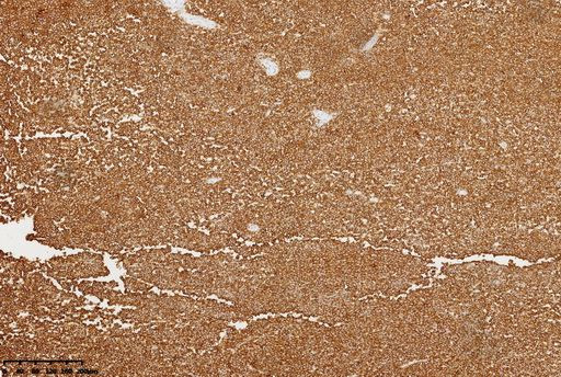 CD45 Antibody in Immunohistochemistry (Paraffin) (IHC (P))