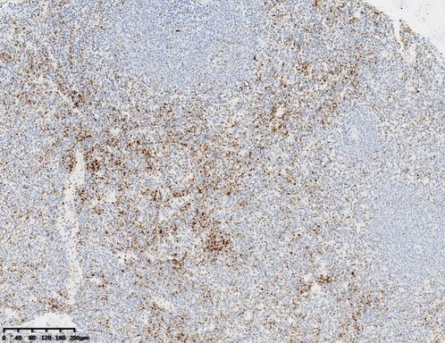 CD61 Antibody in Immunohistochemistry (Paraffin) (IHC (P))