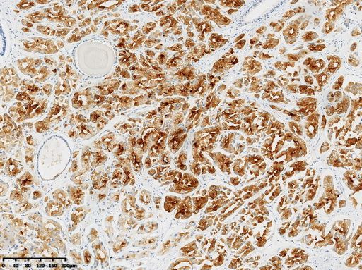 PSMA Antibody in Immunohistochemistry (Paraffin) (IHC (P))