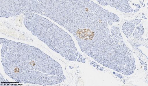 CHGA Antibody in Immunohistochemistry (Paraffin) (IHC (P))
