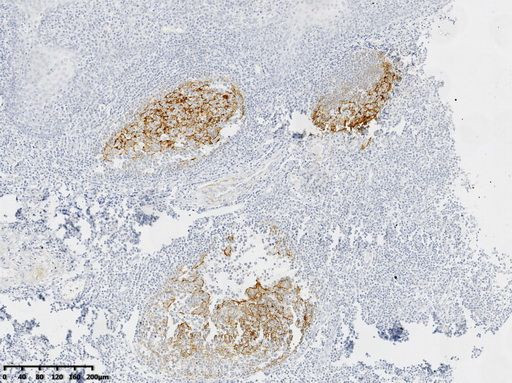 CD21 Antibody in Immunohistochemistry (Paraffin) (IHC (P))