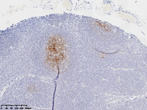 CD21 Antibody in Immunohistochemistry (Paraffin) (IHC (P))