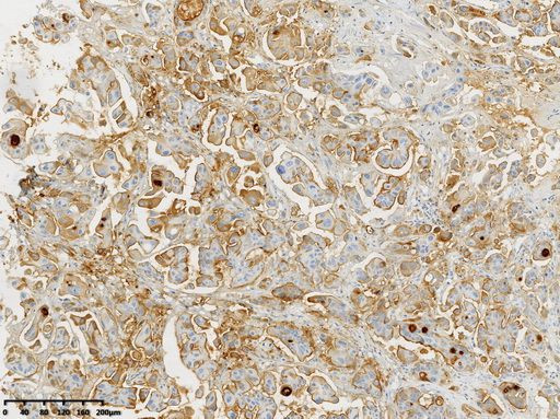 MSLN Antibody in Immunohistochemistry (Paraffin) (IHC (P))