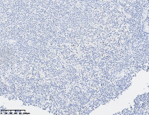 Perforin-1 Antibody in Immunohistochemistry (Paraffin) (IHC (P))