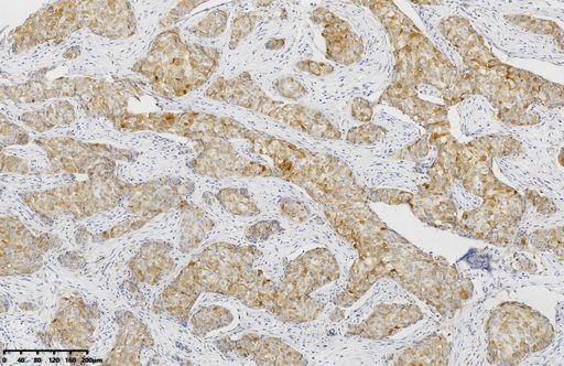 GS Antibody in Immunohistochemistry (Paraffin) (IHC (P))