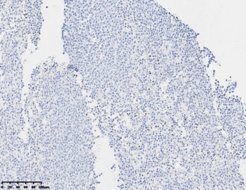 Perforin-1 Antibody in Immunohistochemistry (Paraffin) (IHC (P))