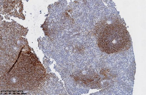 CD21 Antibody in Immunohistochemistry (Paraffin) (IHC (P))