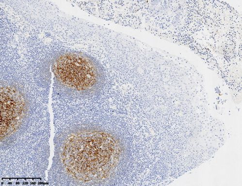 CD21 Antibody in Immunohistochemistry (Paraffin) (IHC (P))