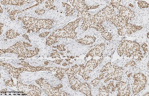 MSH2 Antibody in Immunohistochemistry (Paraffin) (IHC (P))