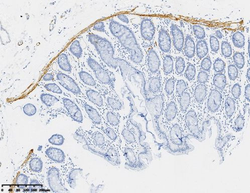 Desmin Antibody in Immunohistochemistry (Paraffin) (IHC (P))