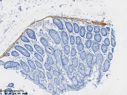 Desmin Antibody in Immunohistochemistry (Paraffin) (IHC (P))