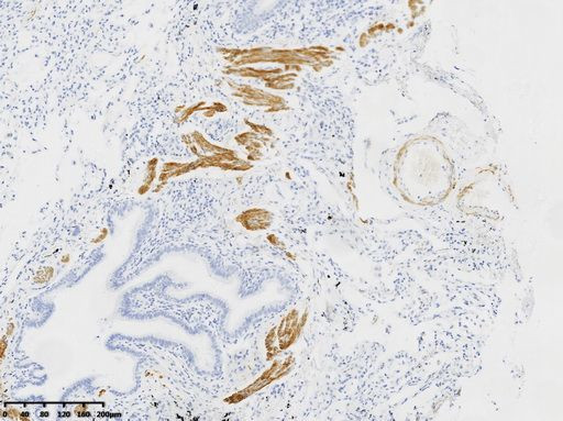 Desmin Antibody in Immunohistochemistry (Paraffin) (IHC (P))