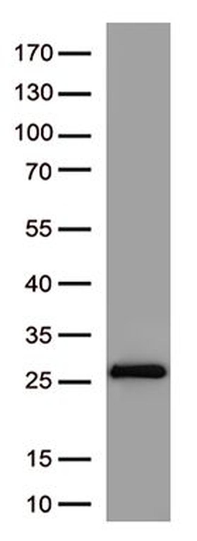 SARS-CoV-2 Spike Protein Antibody in Western Blot (WB)