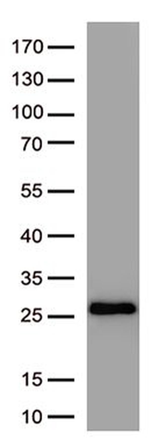 SARS-CoV-2 Spike Protein Antibody in Western Blot (WB)