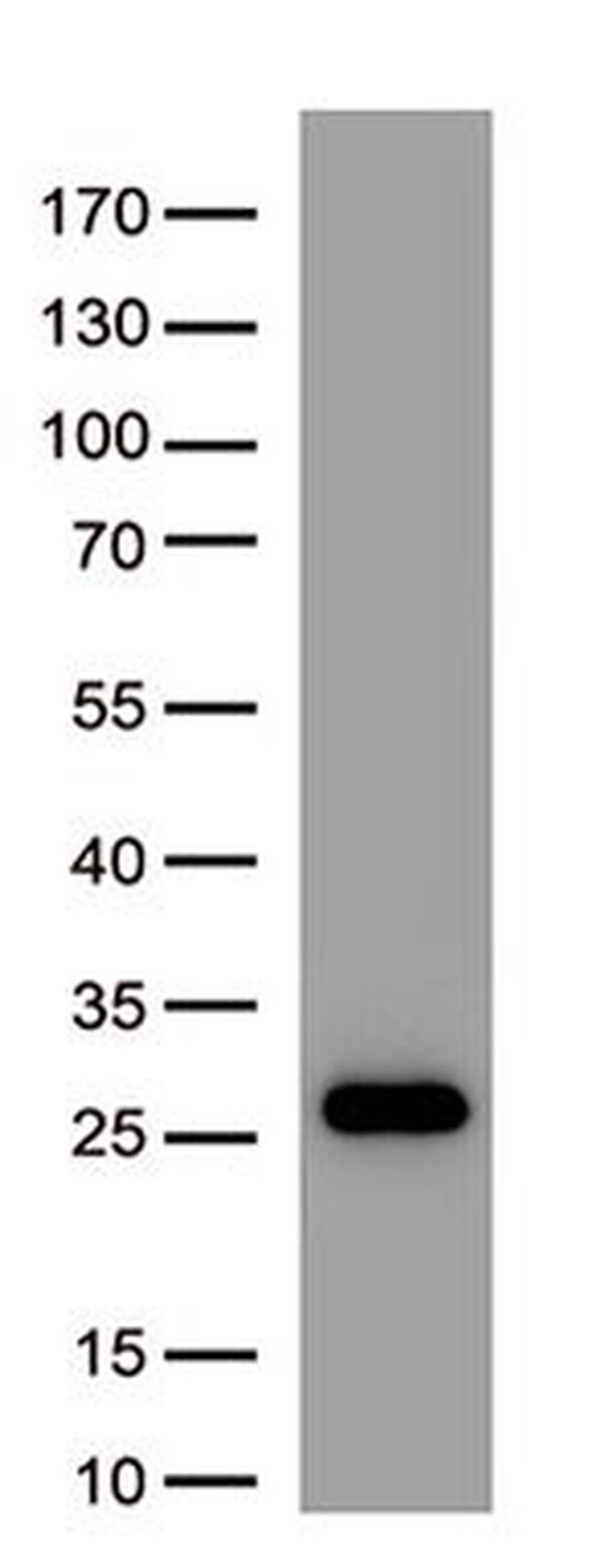 SARS-CoV-2 Spike Protein Antibody in Western Blot (WB)