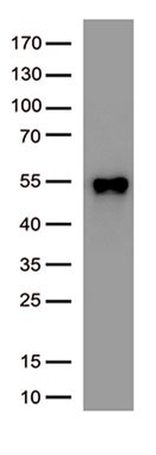 SARS-CoV-2 N Protein Antibody in Western Blot (WB)