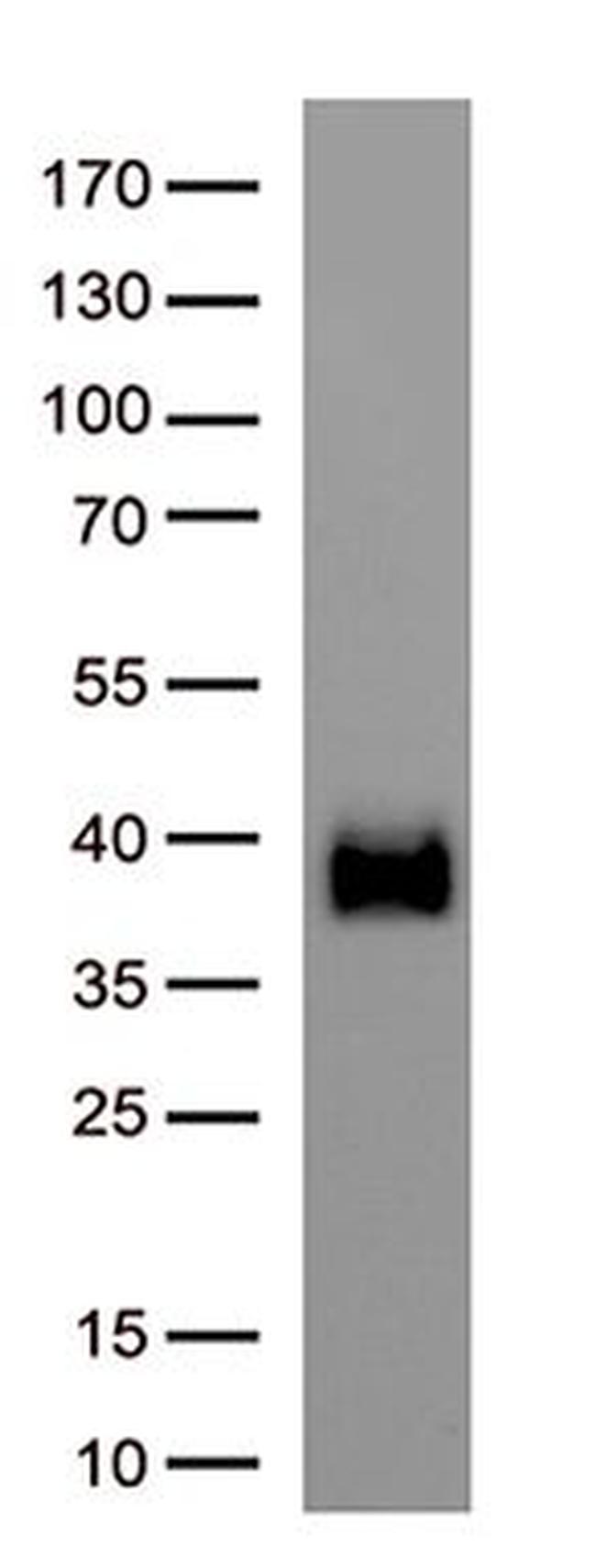 SARS-CoV-2 Spike Protein Antibody in Western Blot (WB)