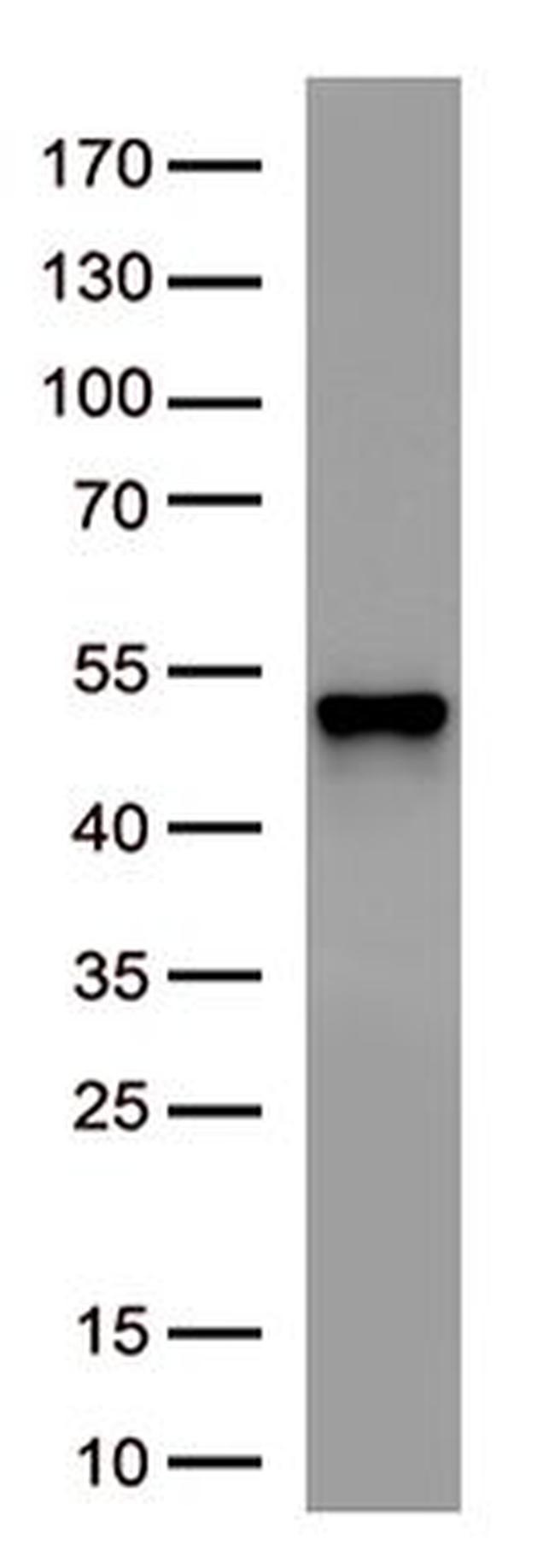SARS-CoV-2 N Protein Antibody in Western Blot (WB)