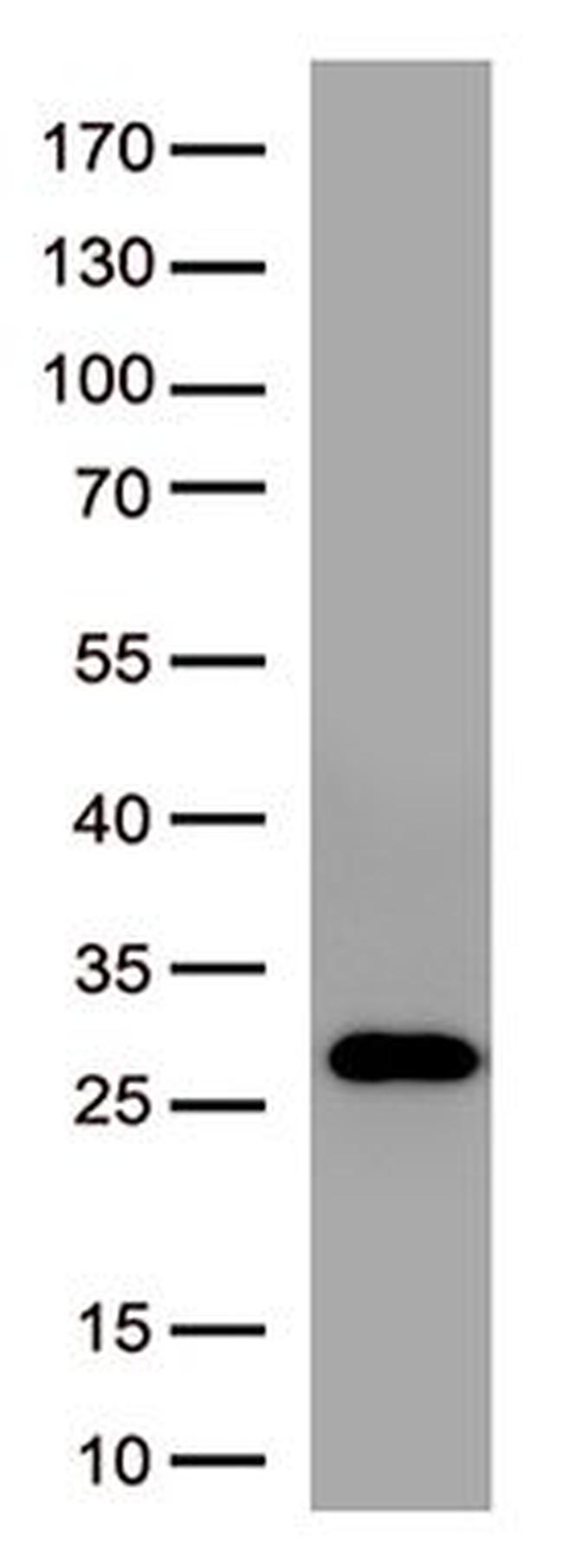 SARS-CoV-2 Spike Protein Antibody in Western Blot (WB)