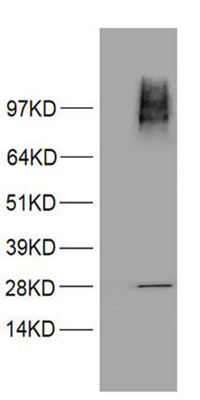 PMS2 Antibody in Western Blot (WB)