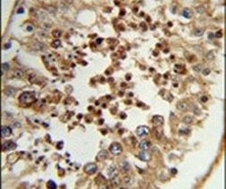 TC2N Antibody in Immunohistochemistry (IHC)